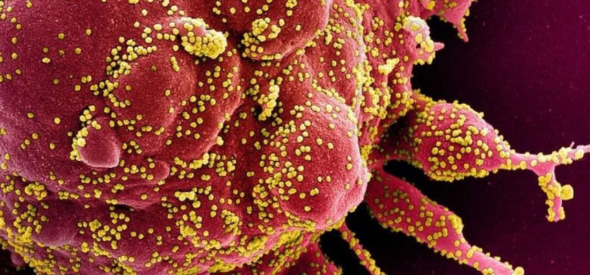 Kajian menunjukkan COVID-19 dapat memaksa sistem imun menyerang diri 