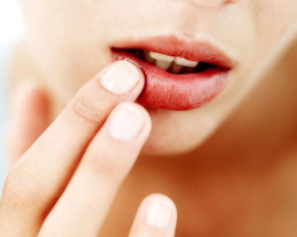 mengapa bibir membakar 