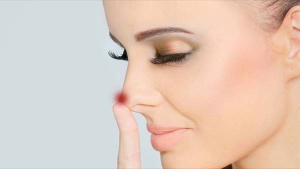 jerawat di hidung 