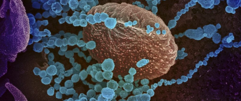 Para saintis telah melihat bagaimana sistem ketahanan badan kita melawan coronavirus 