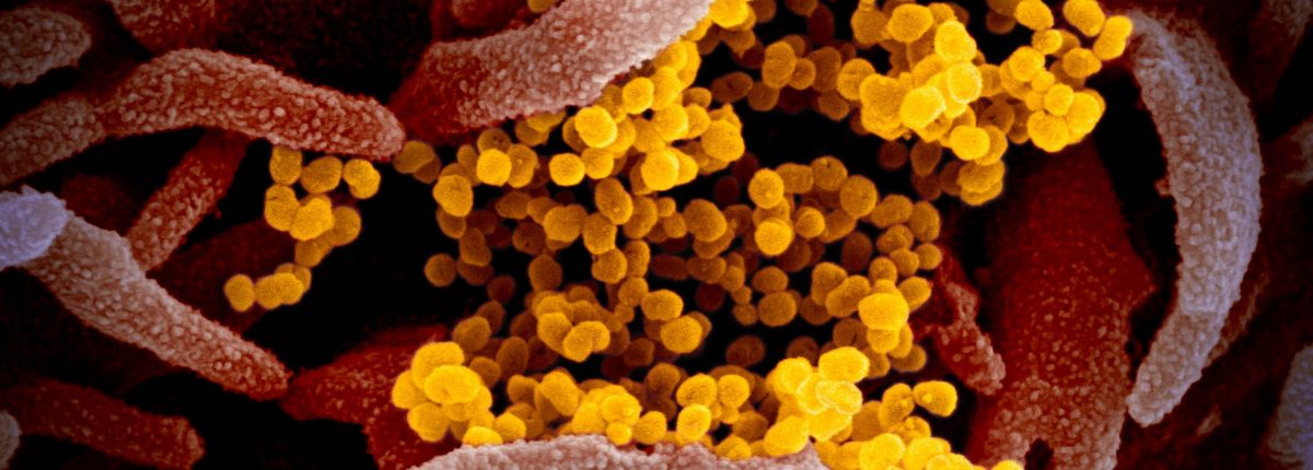 Seperti inilah virus COVID-19 di bawah mikroskop 